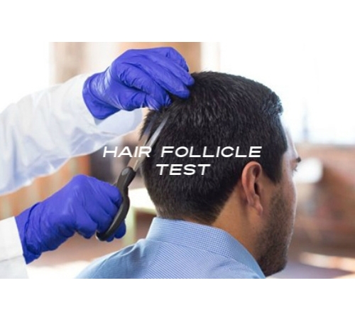 5 Panel 1 Year Hair Test (With Expanded Opiate)