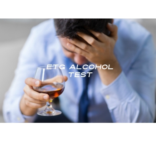 ETG Alcohol Test ( 80 hours of detection) Lab |