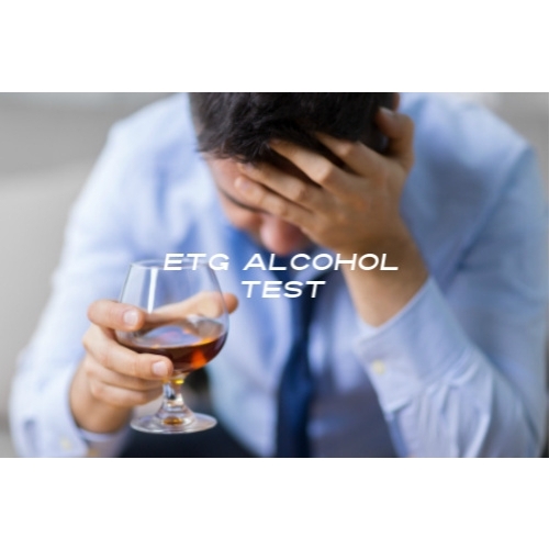 ETG Alcohol Test (80 hours of detection) Lab - Photo 1
